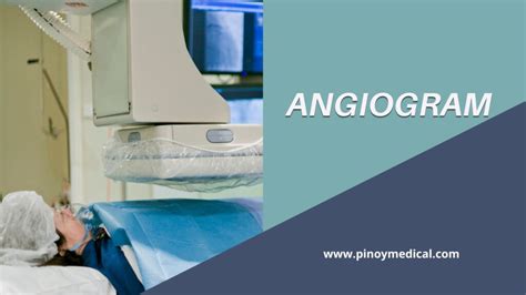 angiogram price philippines